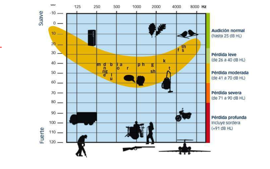 La "Banana del habla": Un concepto clave en la comprensión de la audición y el lenguaje