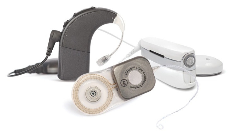 1. Sordera total: Avances en Implantes Cocleares